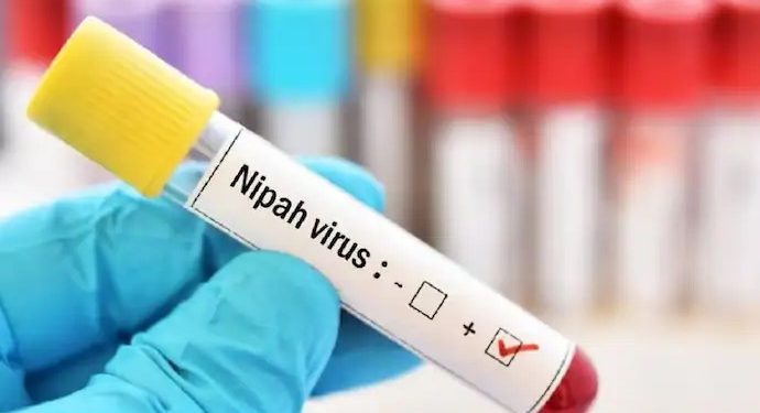 ভারতে নিপাহ ভাইরাসে আক্রান্ত হয়ে আরও একজনের মৃত্যু