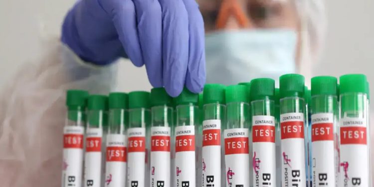 প্রথমবারের মতো যুক্তরাষ্ট্রে শিশুর দেহে বার্ড ফ্লু শনাক্ত