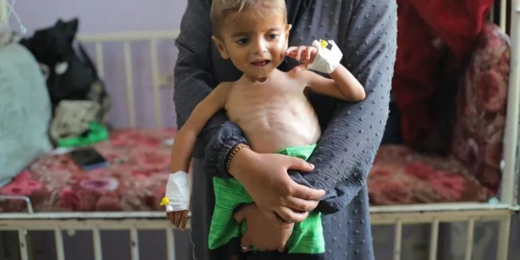 গাজায় বাড়ছে ক্ষুধা , তীব্র অপুষ্টিতে সোয়া ৩ লাখ শিশু