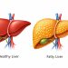 ওষুধ ছাড়াই ৩ উপায়ে কমবে ফ্যাটি লিভার